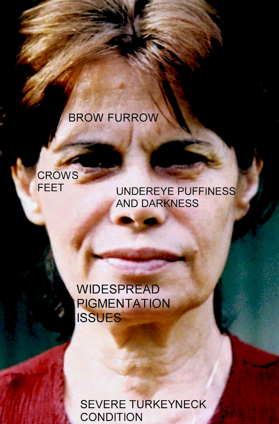 CHART - KATHY COMPLEXION ISSUES 